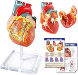 Human Heart Model for Anatomy, 2 Parts (Life Size)